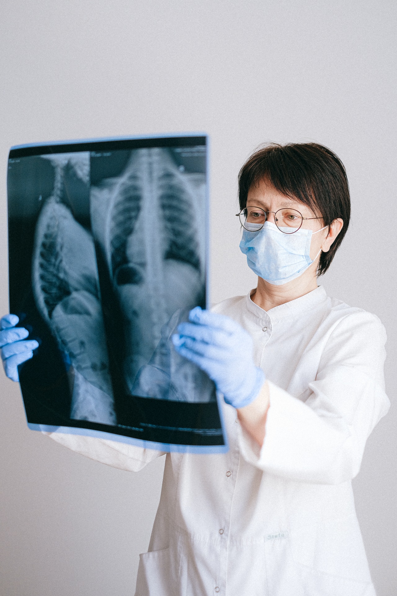 A doctor is holding and looking at human X-ray results