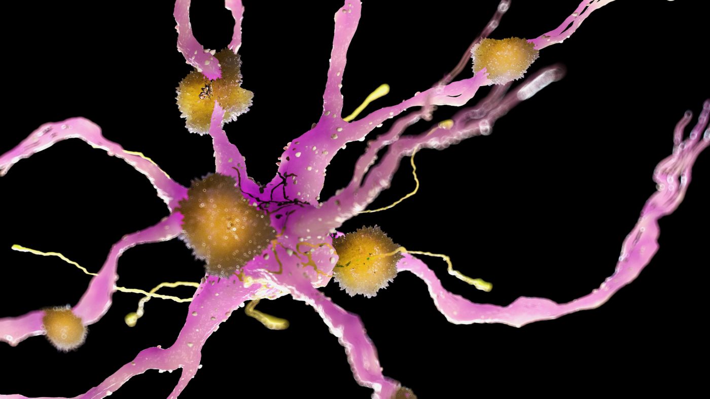 A representation of how a microglia looks in pink surrounded by some cells