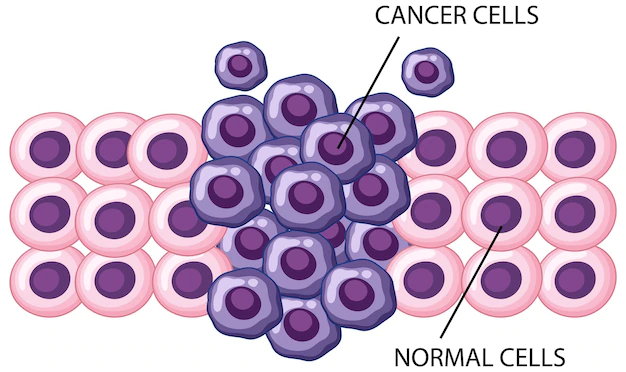 Visual illustration of the process of cancer cell development from normal cells