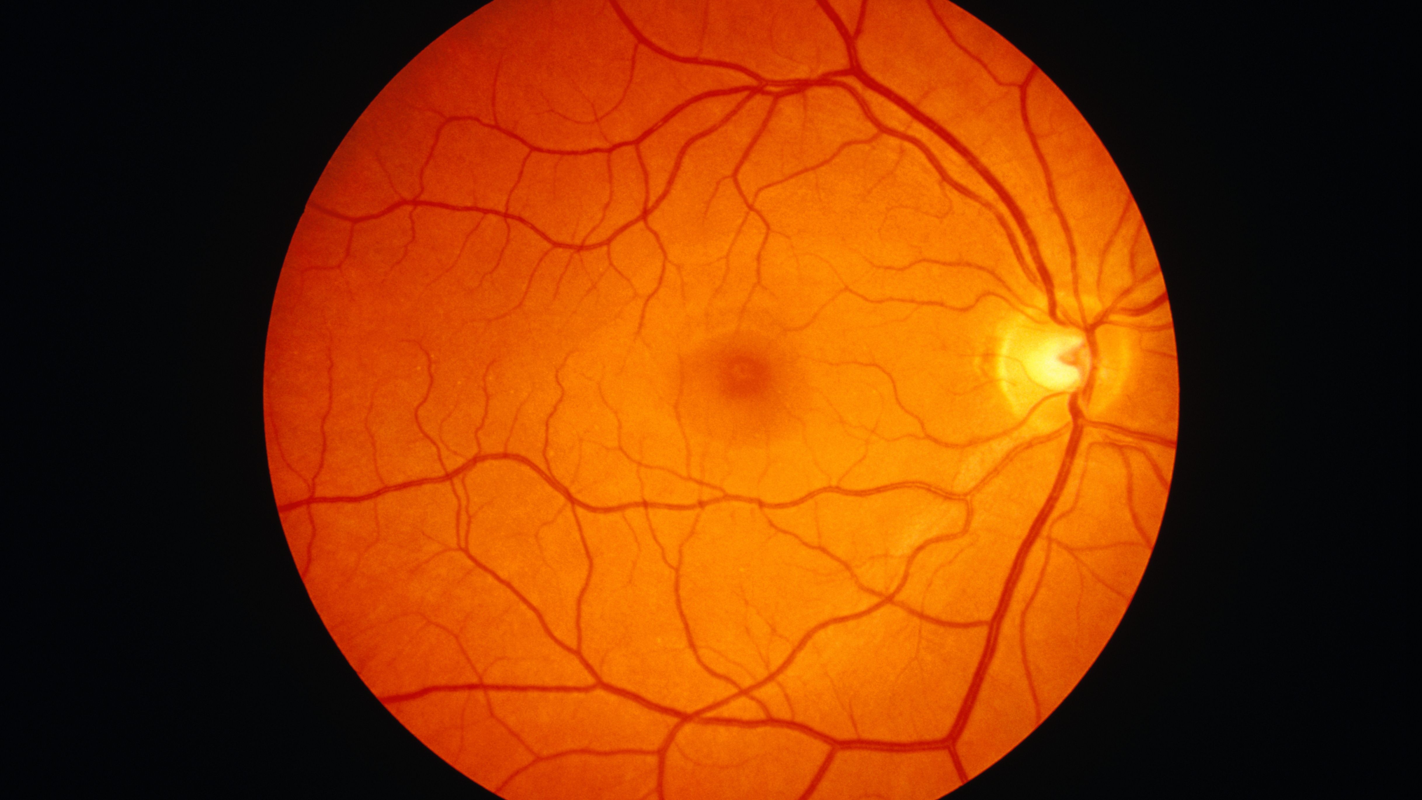 The Human Retina - Intrinsically Photosensitive Ganglion Cells In The Retina