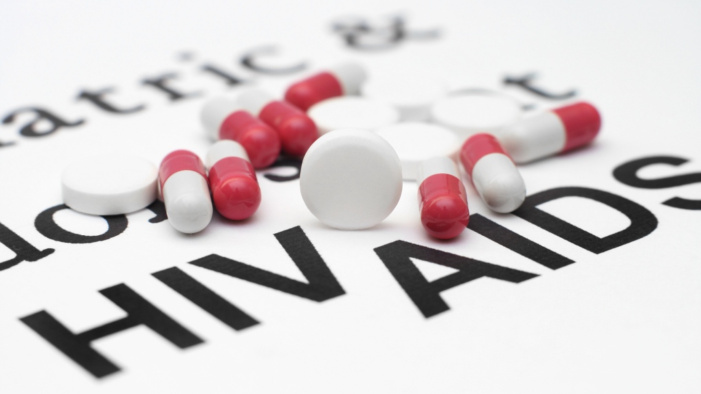 Human Immunodeficiency Virus (HIV) Patients - Exploiting Physiopathology On Acute Coronary Syndrome