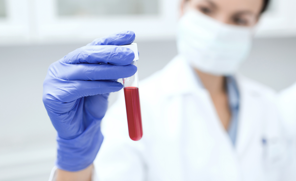 A Single Blood Test Can Detect Various Cancers In The Absence Of Any Visible Symptoms