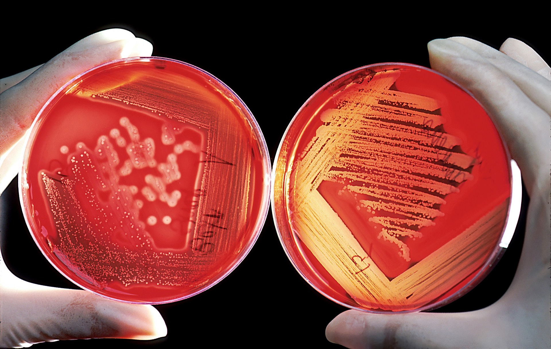 Bacteria Are Destroyed By Strange Antibiotics Used As A Last Resort